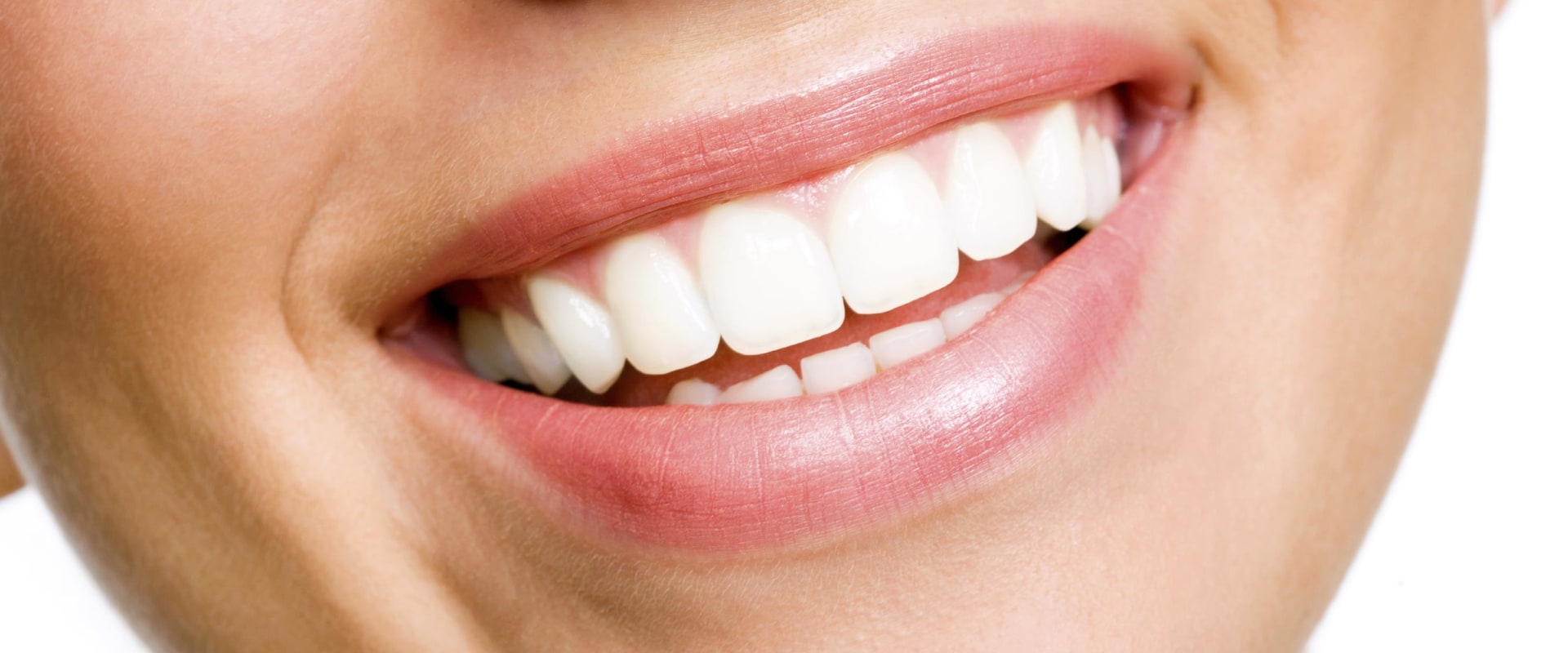 Unlocking the Secrets of a Perfect Smile: San Diego's Top Cosmetic Dentists