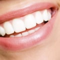 Unlocking the Secrets of a Perfect Smile: San Diego's Top Cosmetic Dentists