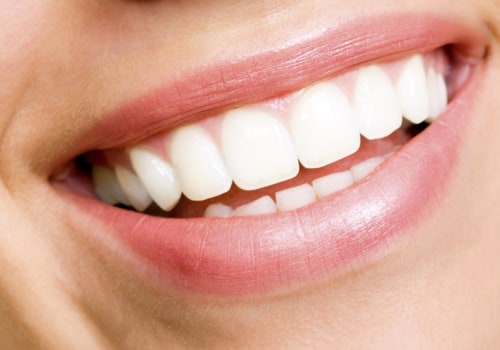 Unlocking the Secrets of a Perfect Smile: San Diego's Top Cosmetic Dentists